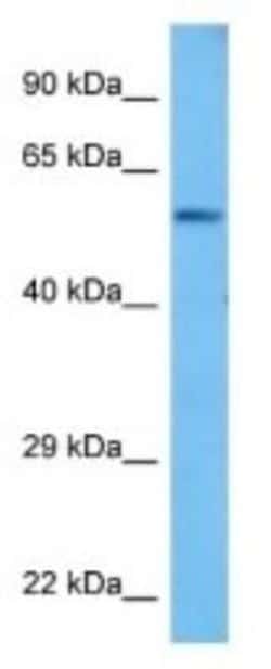 PPP2R2A Rabbit anti-Mouse, Polyclonal, Novus Biologicals 100 &mu;g | Buy Online | Novus Biologicals | Fisher Scientific